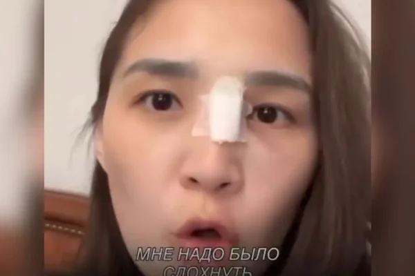 Өтемақыға футболка: «Ақтөбе» ФК жанкүйердің басын жарғаны үшін жеңіл құтылмақ болған